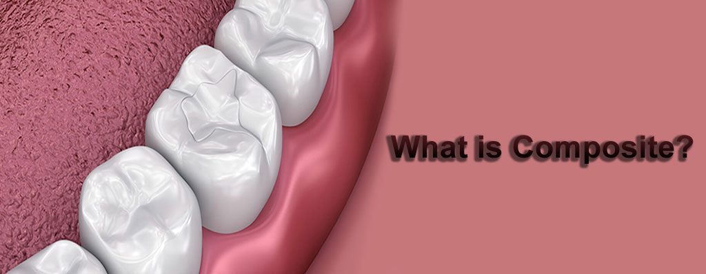 کامپوزیت چیست