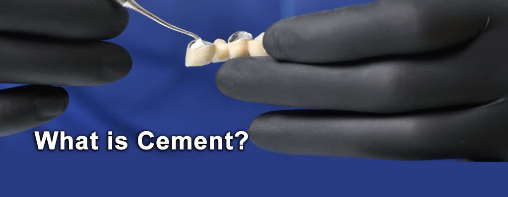 سمان دندانپزشکی چیست و کاربرد آن