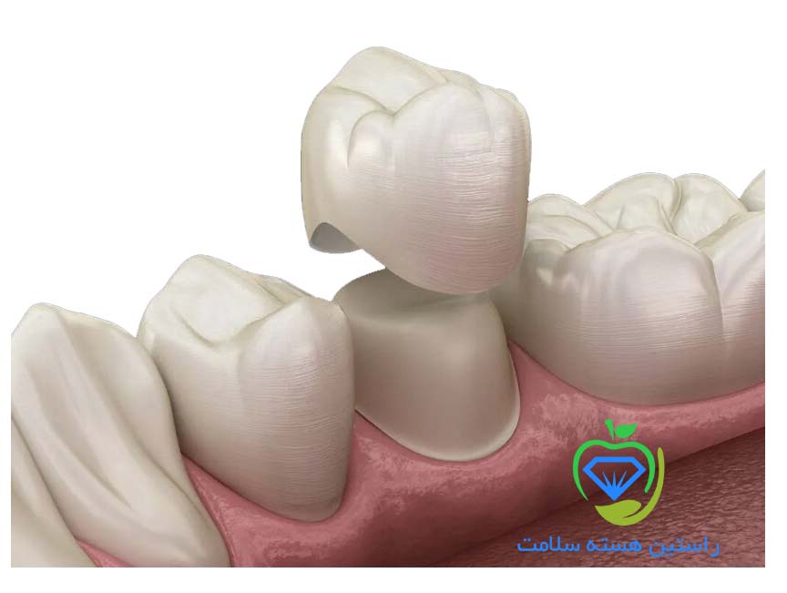 سمان دندانپزشکی چیست و کاربرد آن