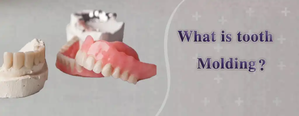 قالب گیری دندان برای چیست